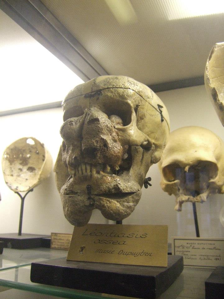 Dupuytren museum (closed)