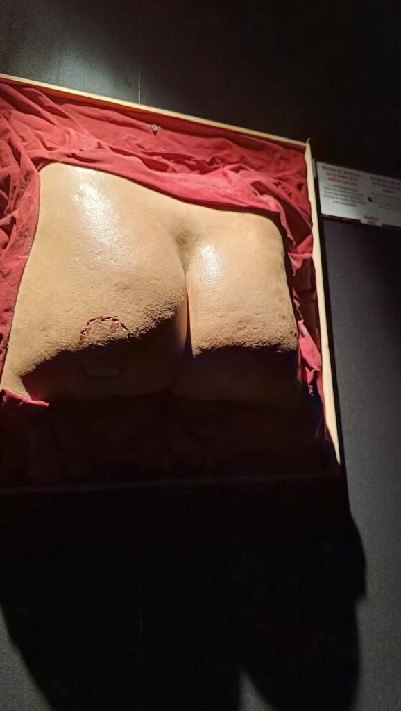 Ted bundy's teeth marks serial killer exhibition