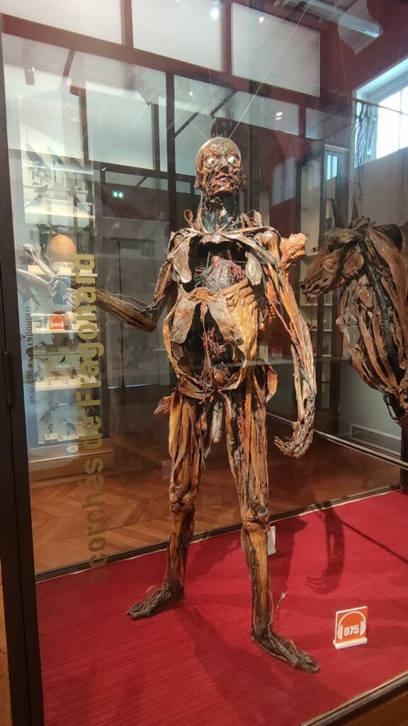 écorchés de fragonard paris